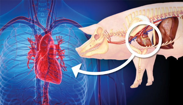 story-on-xenotransplantation-process